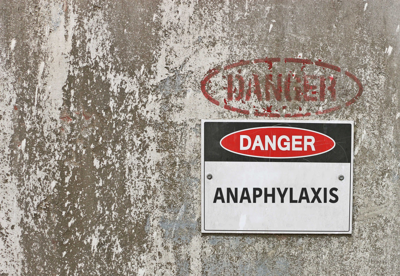 The Effects of Anaphylaxis on the Body