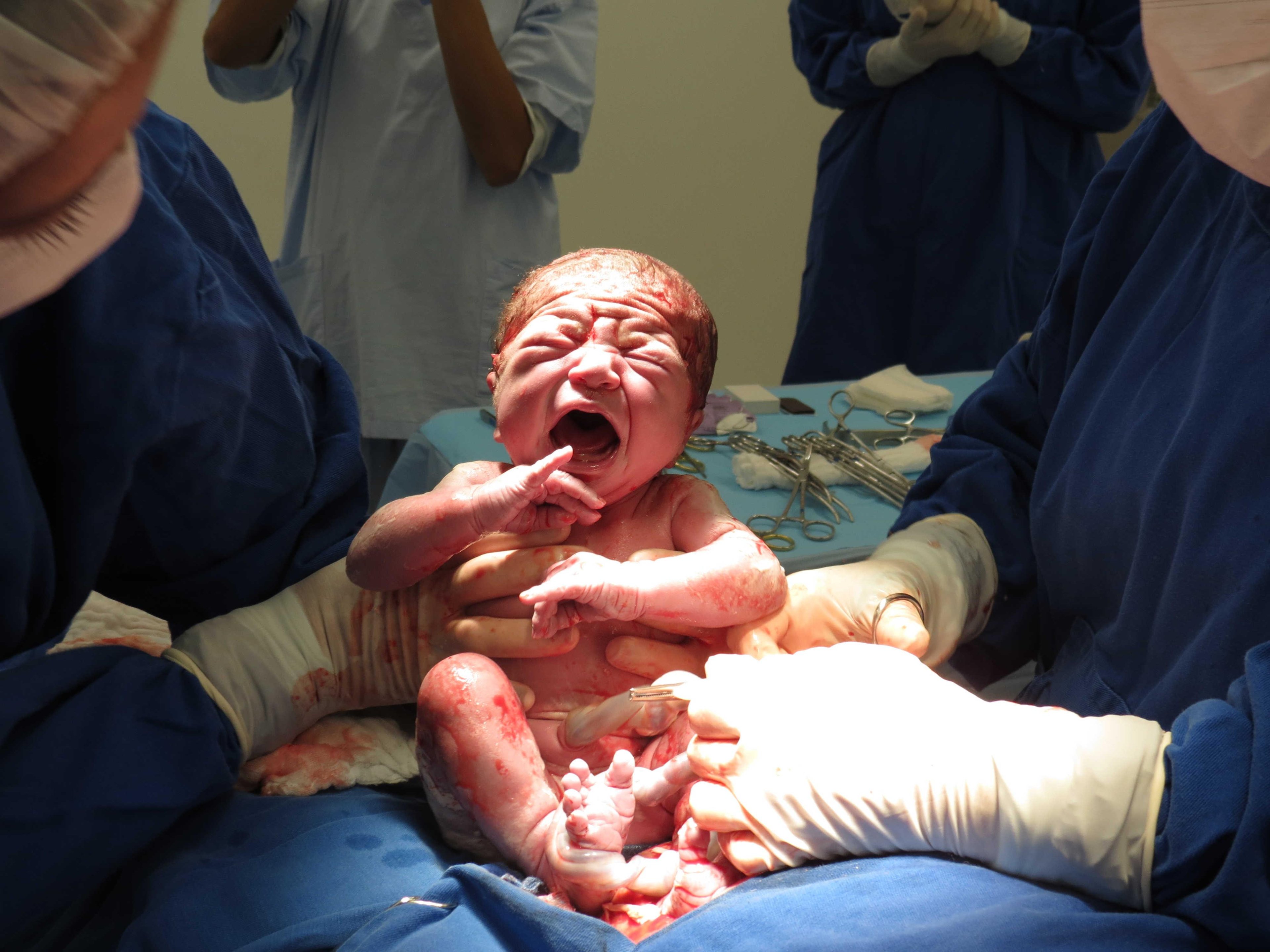 Episiotomies: What Your Mom Never Knew