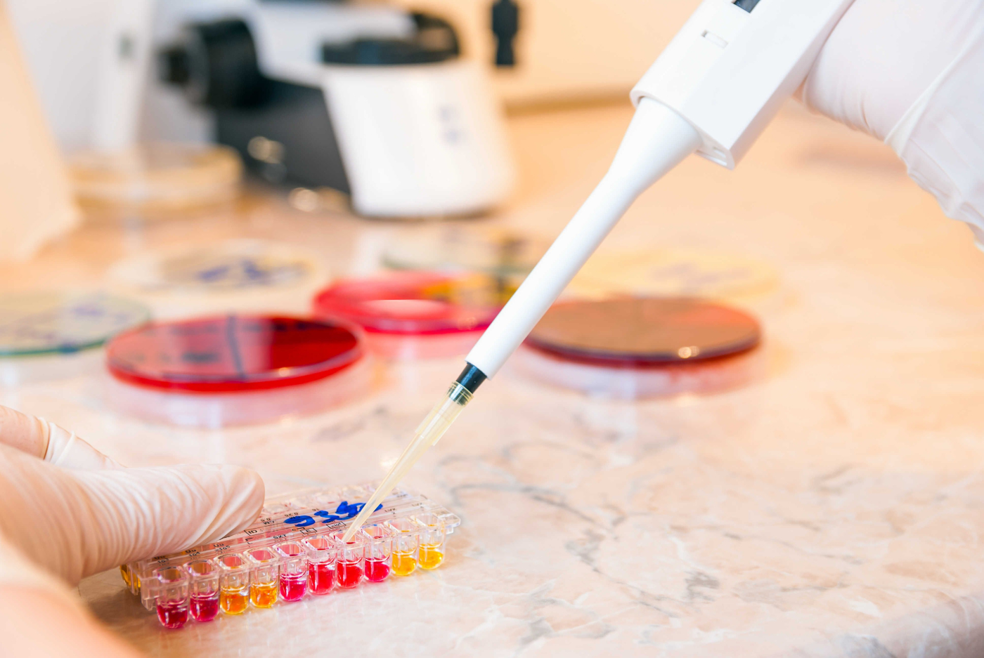 Ujian Genetik semasa Kehamilan