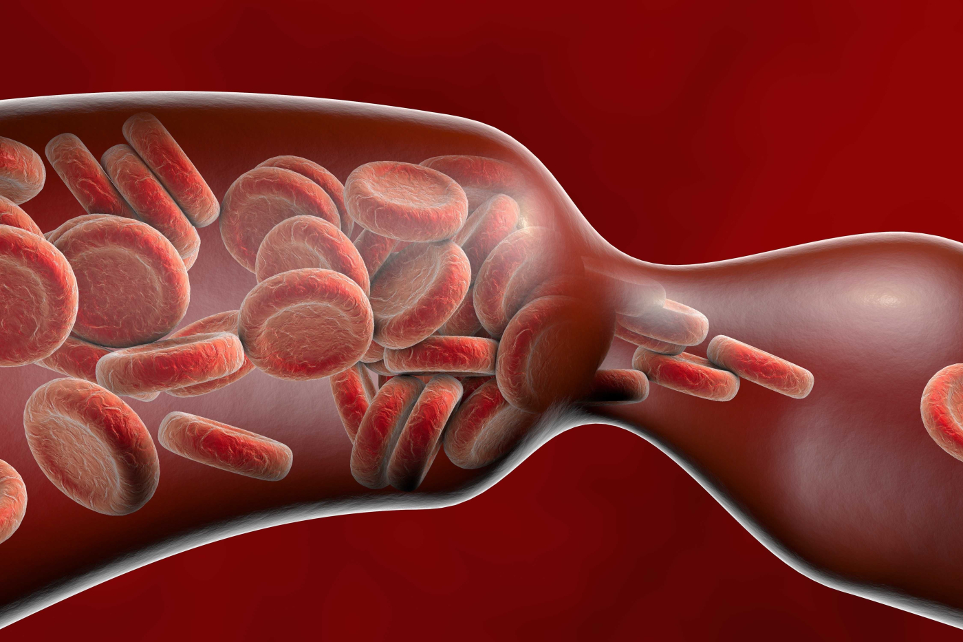 Apakah yang Dimaksudkan Vasodilatasi dan Vasokonstriksi?