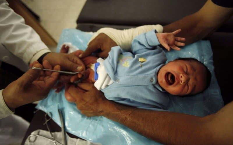 Sunat: Apakah Manfaat dan Risikonya?