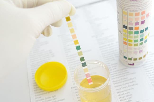Having Protein in Your Urine