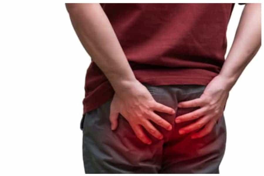 Info Lengkap Buasir: Ini Punca, Simptom & Rawatannya