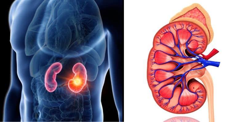 Nefritis Interstitial - Penyakit Yang Buatkan Ginjal Alami Keradangan Dan Membengkak!