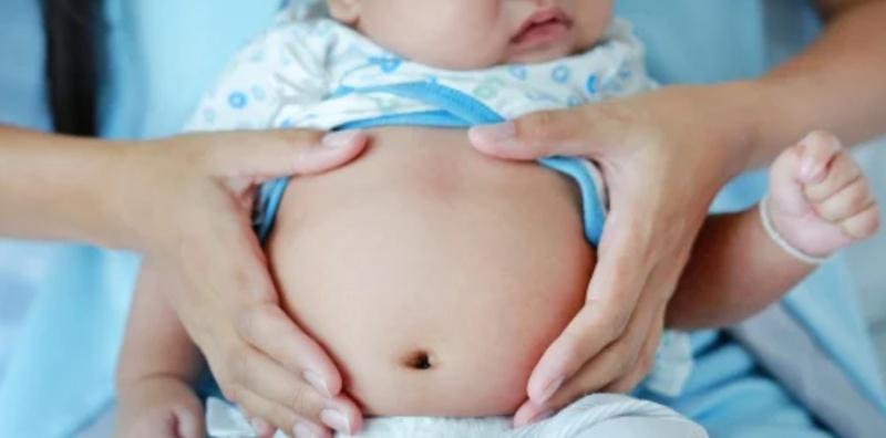 Apa Itu Atresia Biliari Yang Biasa Berlaku Kepada Bayi? Ia Menjejaskan Organ Mereka?