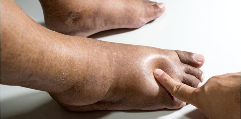 5 Cara Penjagaan Ini Dapat Bantu Elak KOMPLIKASI Diabetes, No. 4 Penting Kalau Sayangkan Penglihatan!