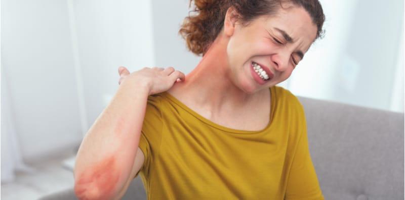 Anda Perlu Ambil Tahu Mengenai Anafilaksis Atau BAHAYA Menanti!