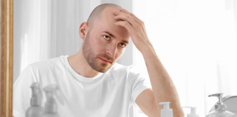 Lelaki Botak Dikatakan Berisiko Alami Sakit Jantung, Semak Fakta Ini Untuk Tahu!