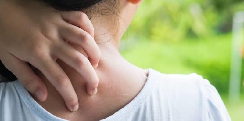 Kulit Kering Dalam Kanak Kanak, Ini Perkara Yang Semua Ibu Bapa Perlu Tahu!