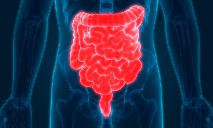 3 Tip Berpuasa Bagi Pesakit Radang Usus