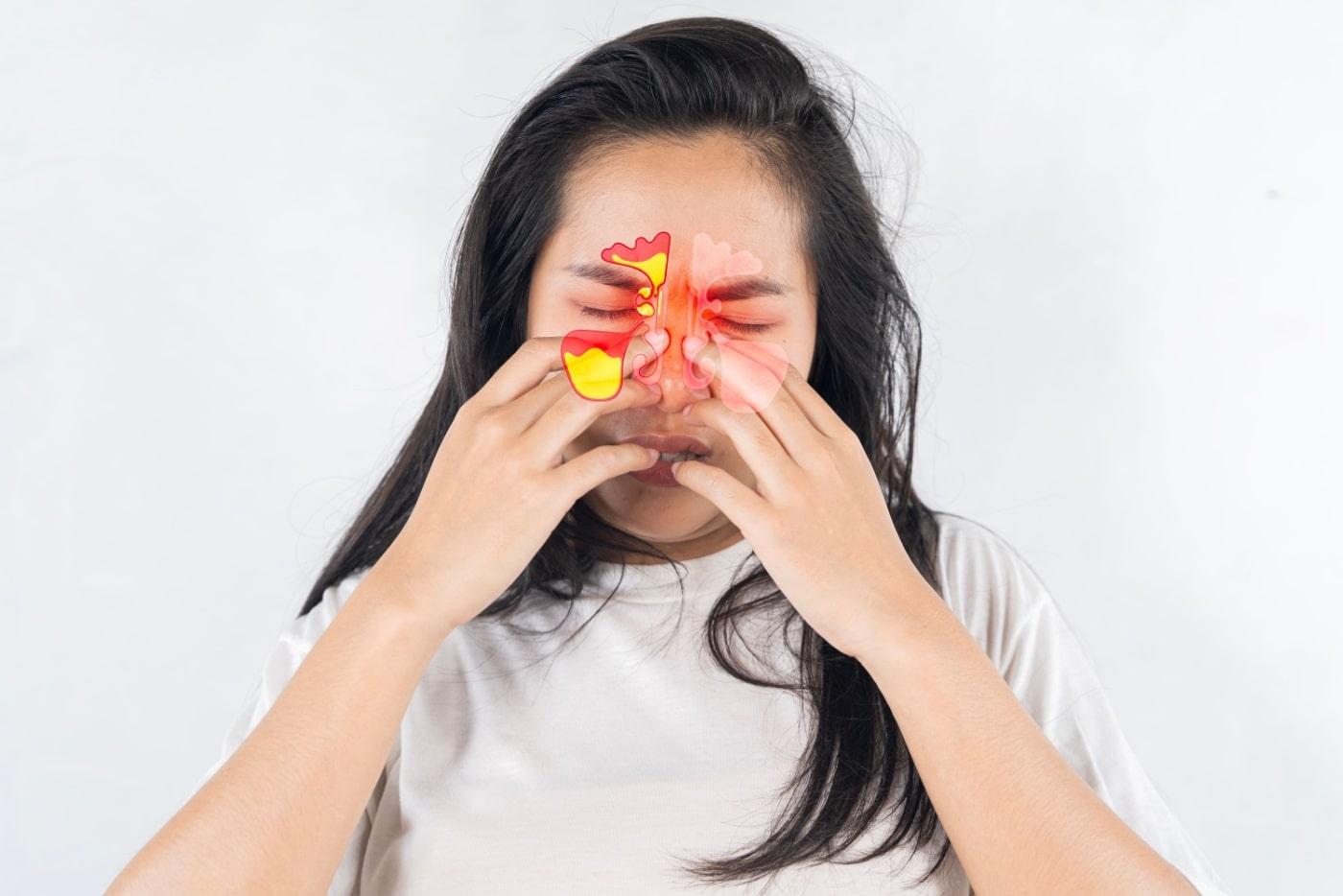 Sinusitis Kronik: Adakah Anda Juga Alaminya? Semak Tanda Di Sini!