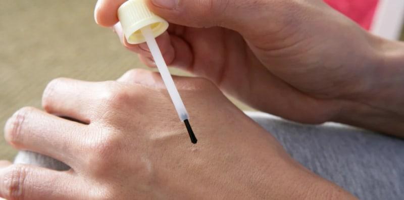 Kutil Penuh Di Badan? Ini Punca & Cara Buang Ketuat Yang Anda Boleh Cuba!