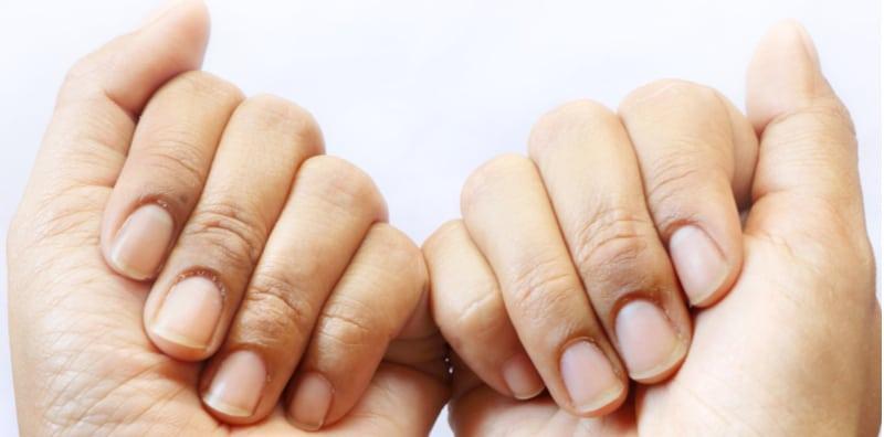 Kenapa Kuku Anda Menjadi Kuning? Tak Sangka, Rokok Juga Beri Kesan Rupanya!