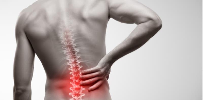 Ankylosing Spondylitis: Gejala, Punca Dan Rawatan Bersesuaian