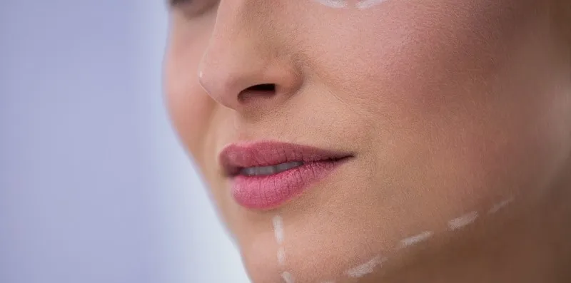 Pembetulan Tulang Rahang