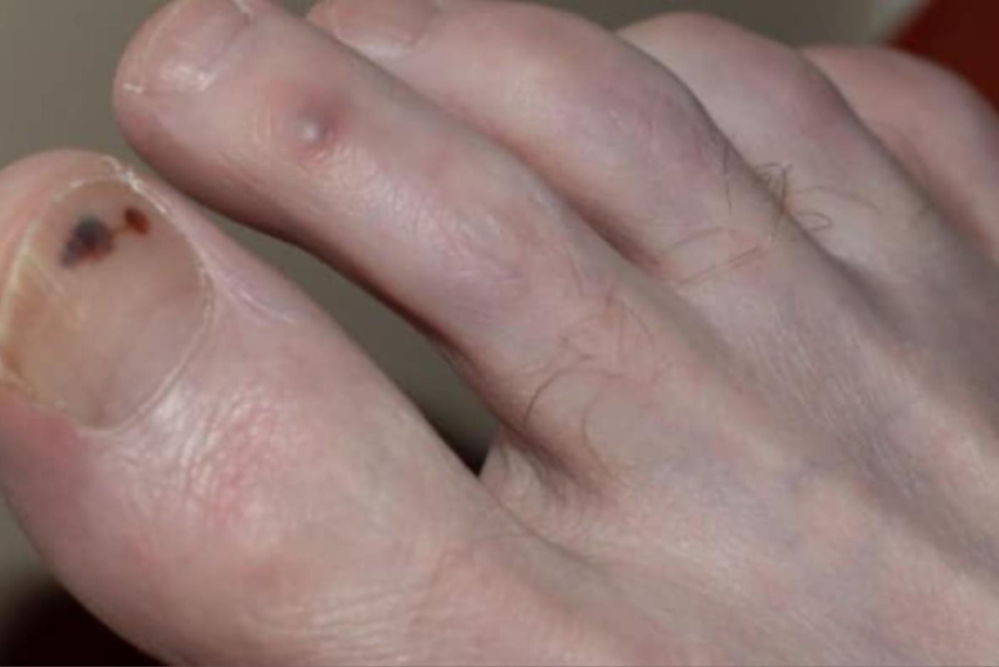 Kuku Warna Hitam? Jangan Pandang Remeh! Ini Petanda 5 Penyakit