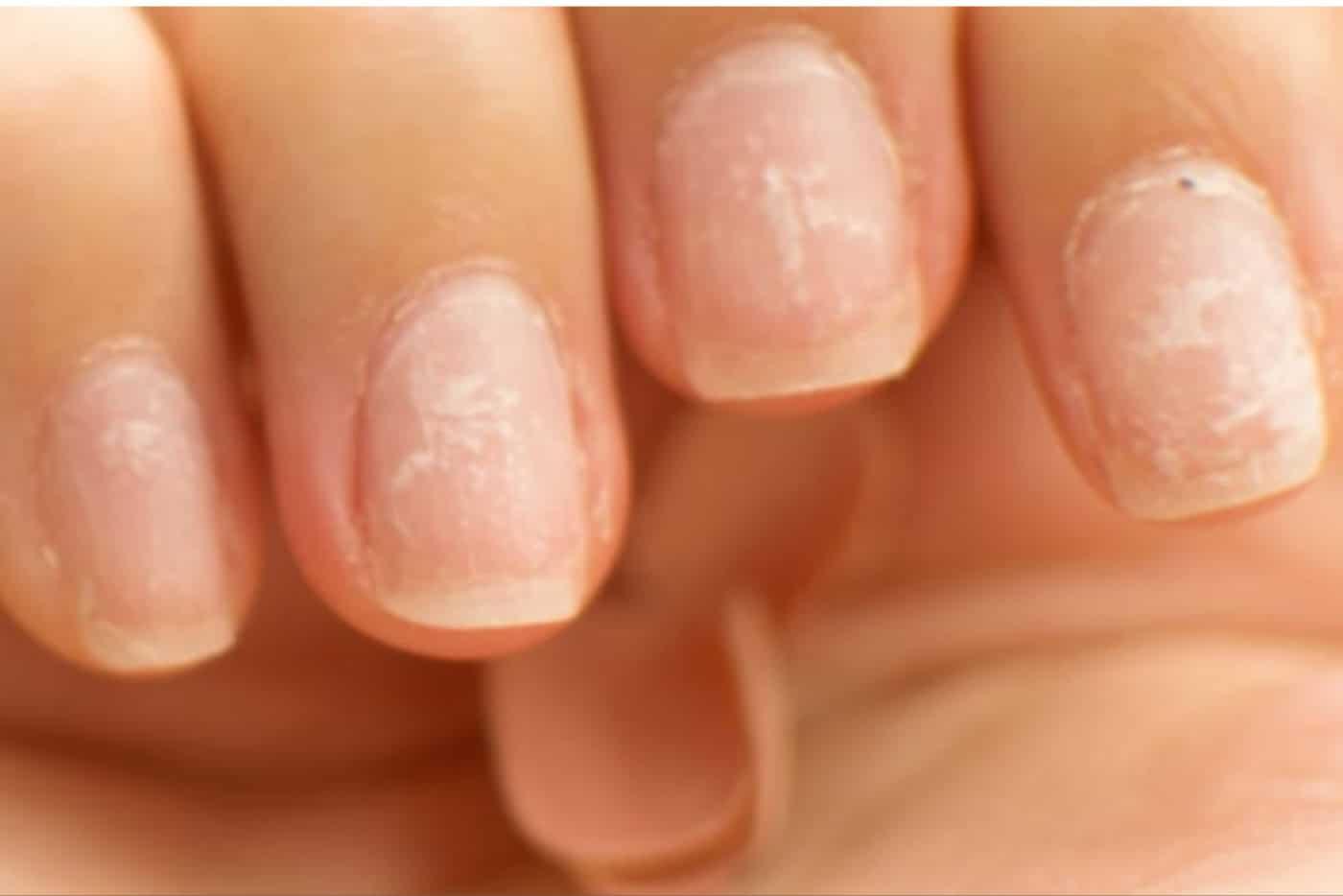 Kuku Petanda Anda Sihat Atau Tidak, Semak 9 Penyakit Ini Melalui Kuku!