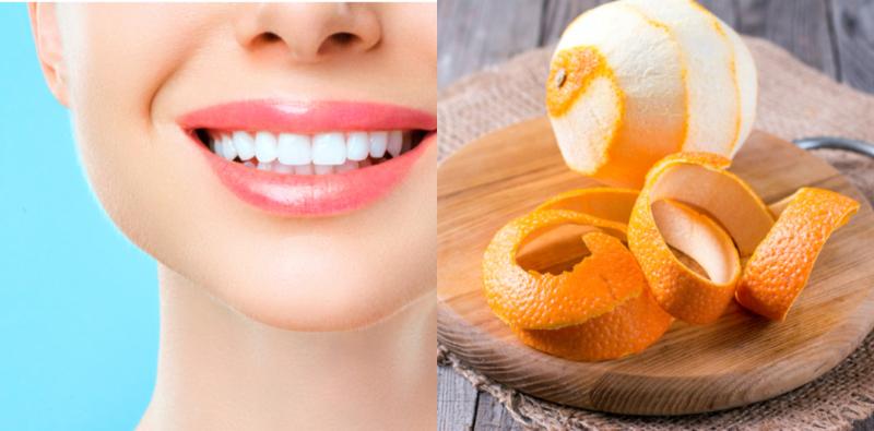 Selain Berus Gigi, Ini 5 Cara Semula Jadi Untuk Putihkan Gigi Yang Berkesan