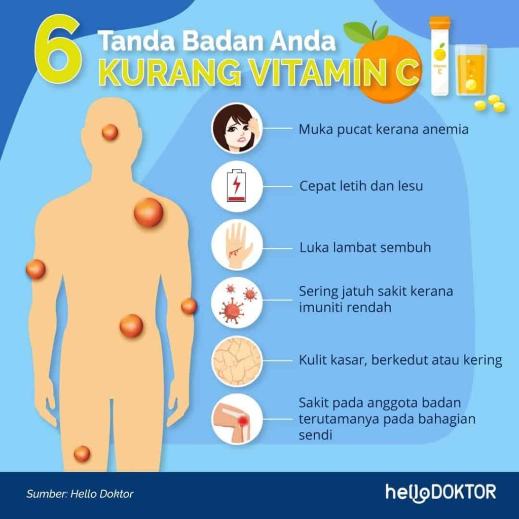 epal hijau