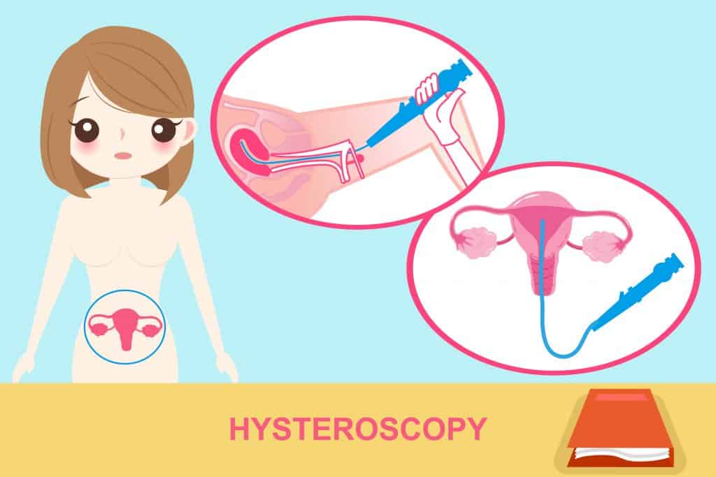 Secondary Dysmenorrhea Bukan Senggugut Biasa Hello Doktor