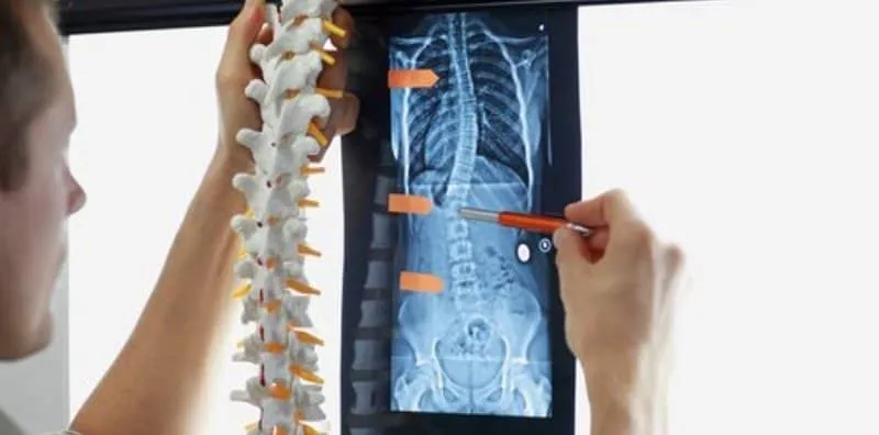5 Perkara Penting Anda Perlu Titik Berat Jika Ada Sakit Tulang Belakang Ini!