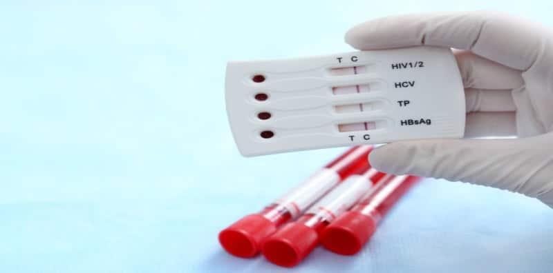 Hubungan Antara HIV dan Jangkitan Hepatitis C