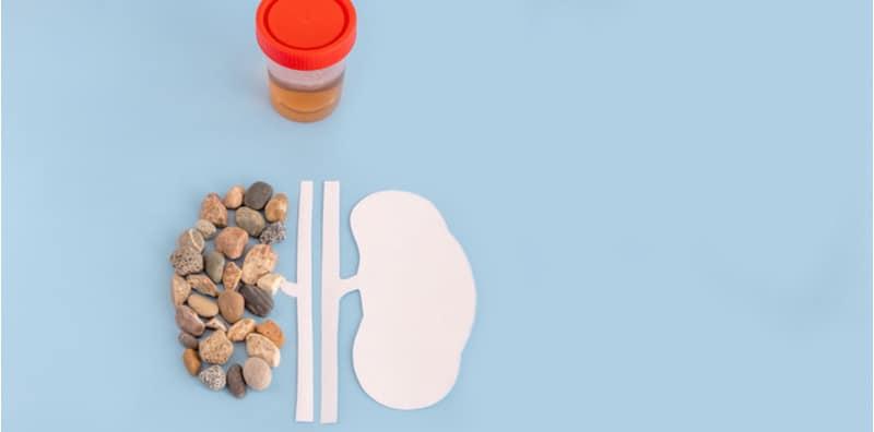 Kencing Sakit & Keluar Darah? Kenali 4 Jenis Batu Karang, Lihat Bagaimana Ia Terbentuk