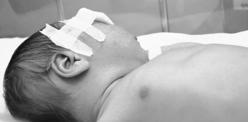 Terkejut Anak Baru Lahir Ada Talasemia, Ini Antara Komplikasi Mungkin Terjadi!