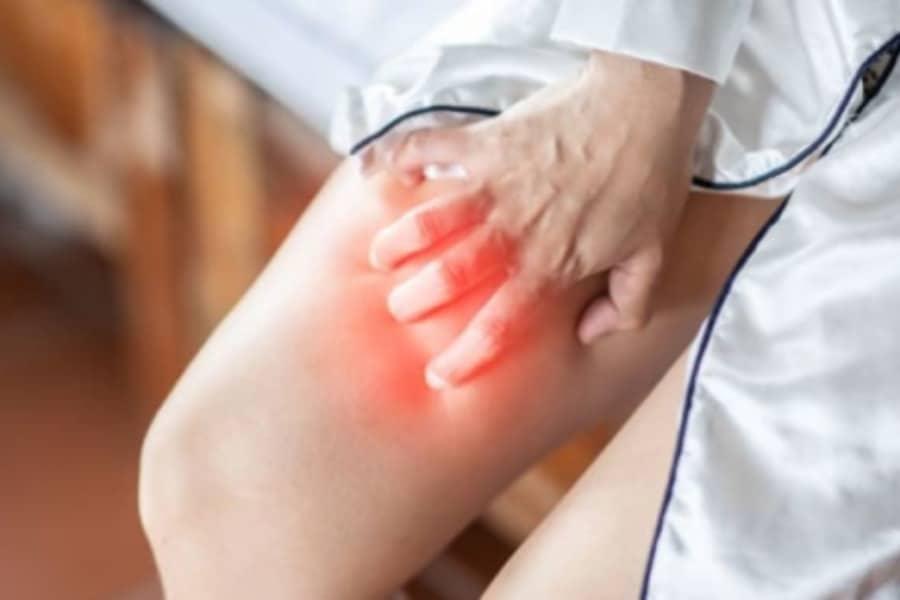 Asyik-Asyik Gatal Celah Paha Sampai Tak Larat Nak Garu, Ini 7 Punca Sebenar!