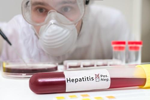 Hepatitis B: 4 Peringkat Jangkitan