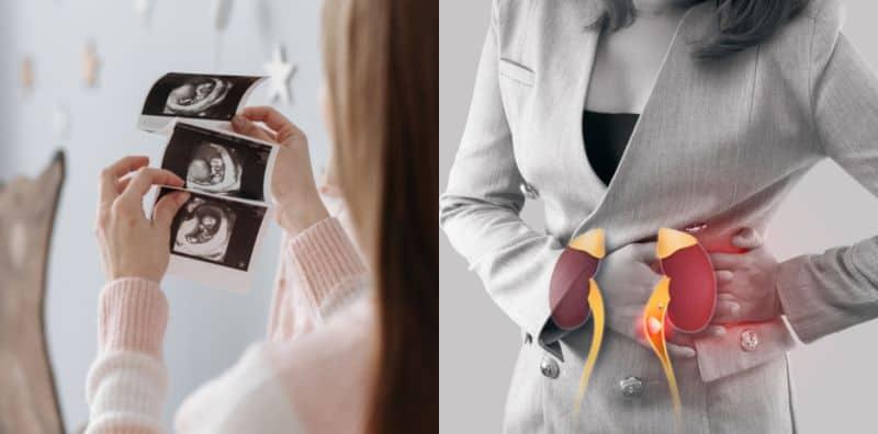 Hamil Tapi Menghidap Penyakit Buah Pinggang? Fahami Komplikasinya Terhadap Kandungan!