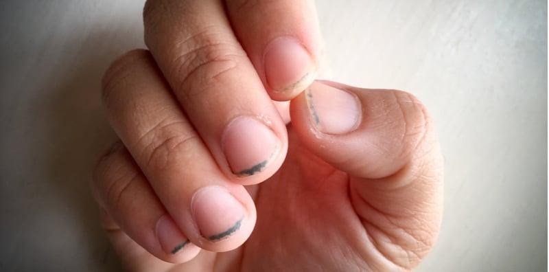 Jangan Biarkan Ia Jadi Hitam! Ini Dia Cara Betul Penjagaan Kuku Tangan & Kaki!