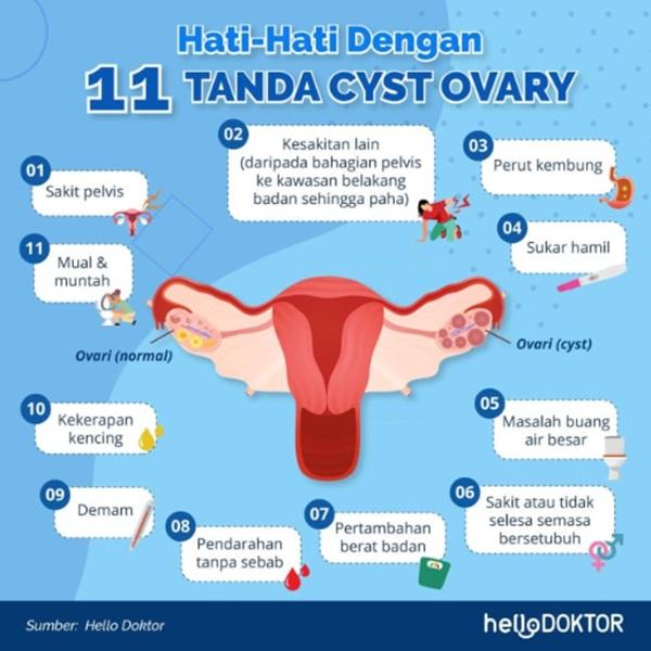 sakit perut sebelah kanan bawah