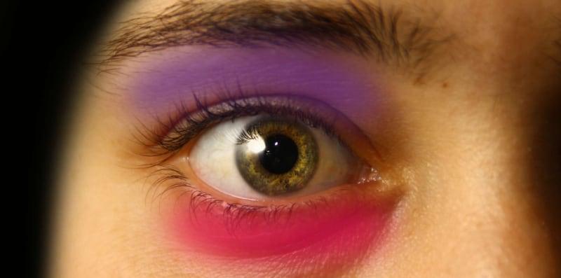 Ini Langkah Mudah Dan Cepat Untuk Buang Kesan Lebam Pada Mata Lebam!