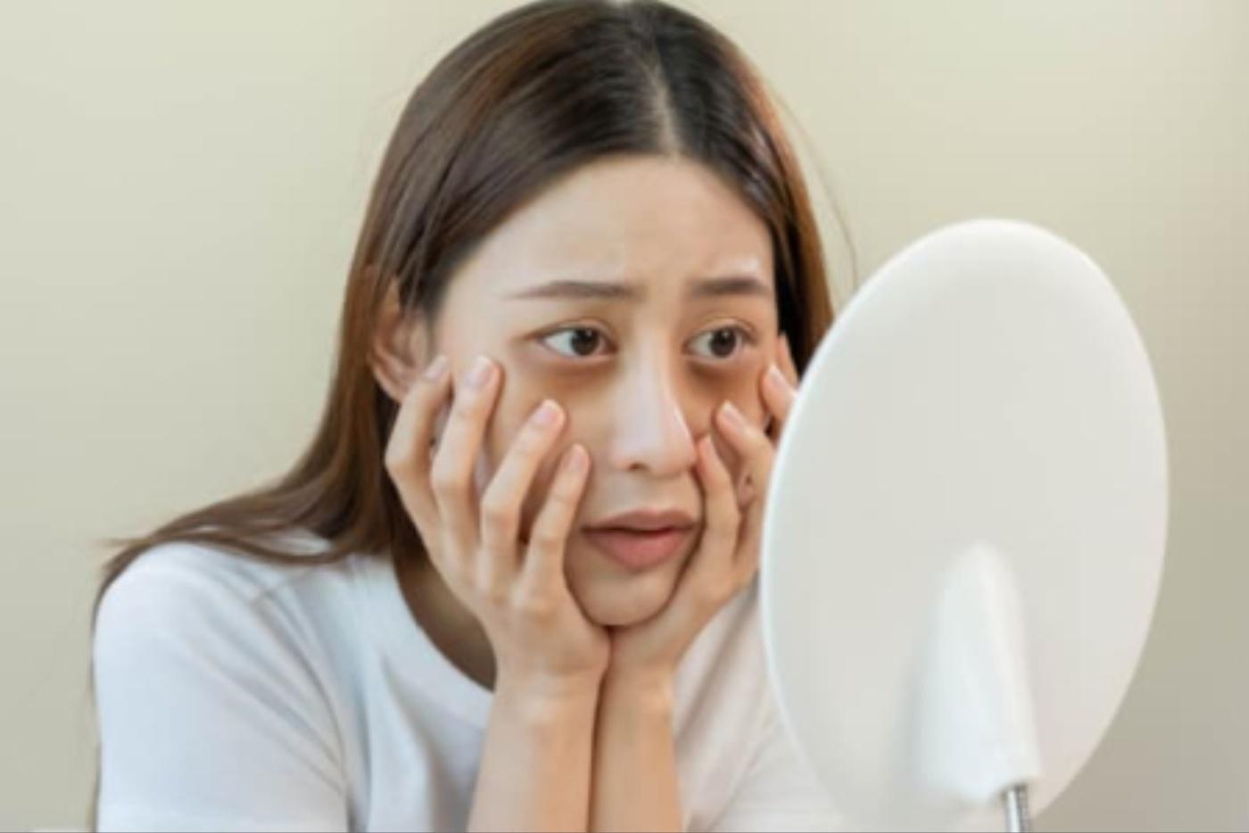 8 Cara Cepat Hilangkan Eyebag Dari Pakar, No. 2 Wajib Buat Kalau Tak Nak Jadi Mata Panda!