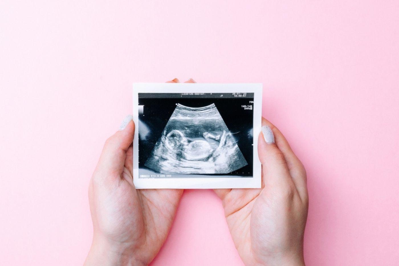 Air Ketuban, Penting Untuk Kekal Pada Paras Normal! Jika Tidak Ini RISIKONYA....