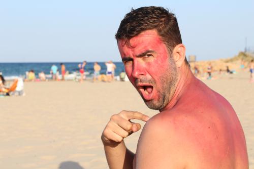 The Best Treatment to Skin Peeling After Sunburn
