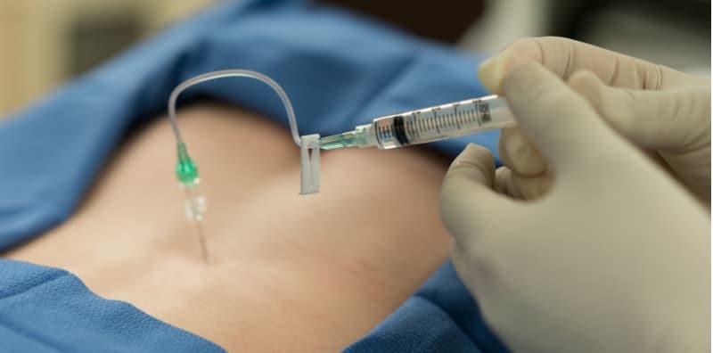 Ini Antara Manfaat & Risiko Epidural Semasa Kelahiran, Ambil Tahu Sebelum Bersalin!