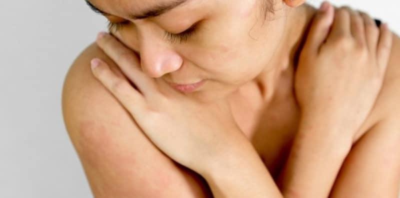 Geligata Boleh Terjadi Akibat Alergi Terhadap Air! Ia Kondisi Jarang Berlaku?