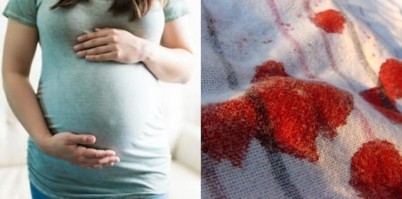 Pendarahan Semasa Hamil