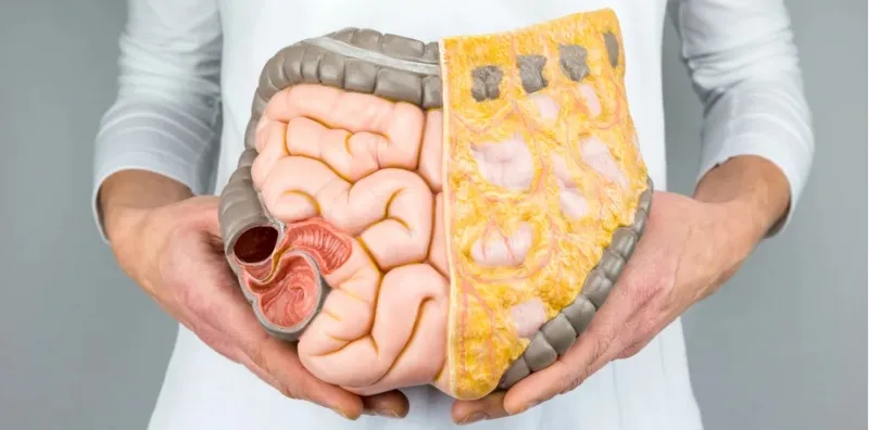 Usus Sihat Datang Dari Pemakanan Yang Baik, Ini 8 Pilihan Makanan Terbaik!