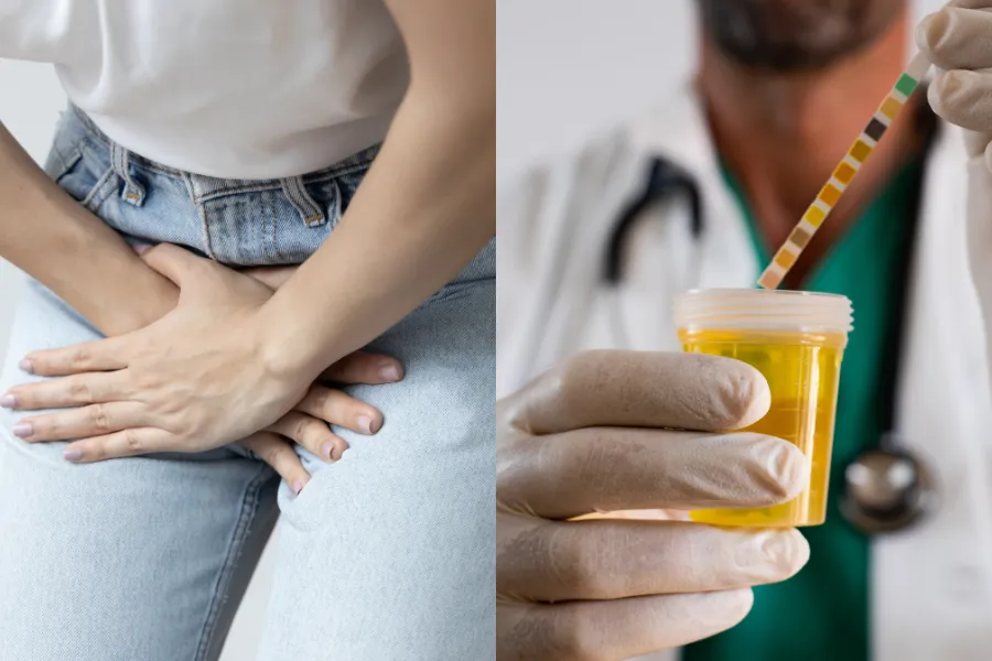 Ada Protein Dalam Air Kencing? AWAS! Ini Bahaya Untuk Buah Pinggang Anda