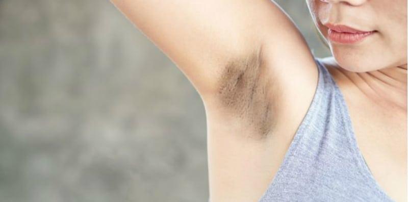 Hati-Hati, Pakar Mengatakan Ketiak Hitam Merupakan Petanda Penyakit Berbahaya!