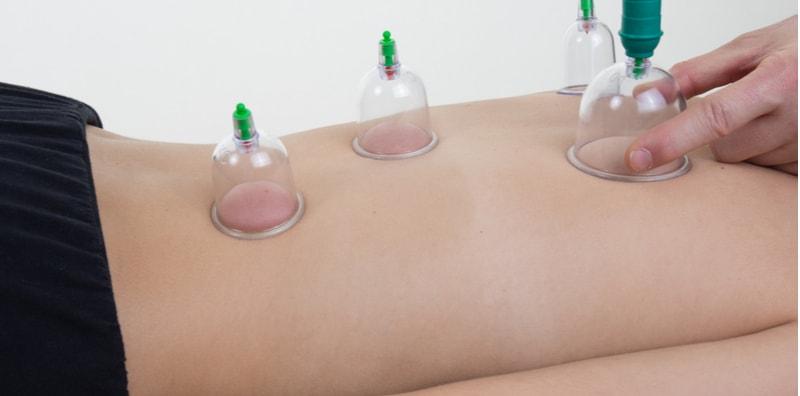 TIADA Bukti Kukuh Bekam Memberi Keberkesanan Untuk Merawat Sebarang Penyakit!