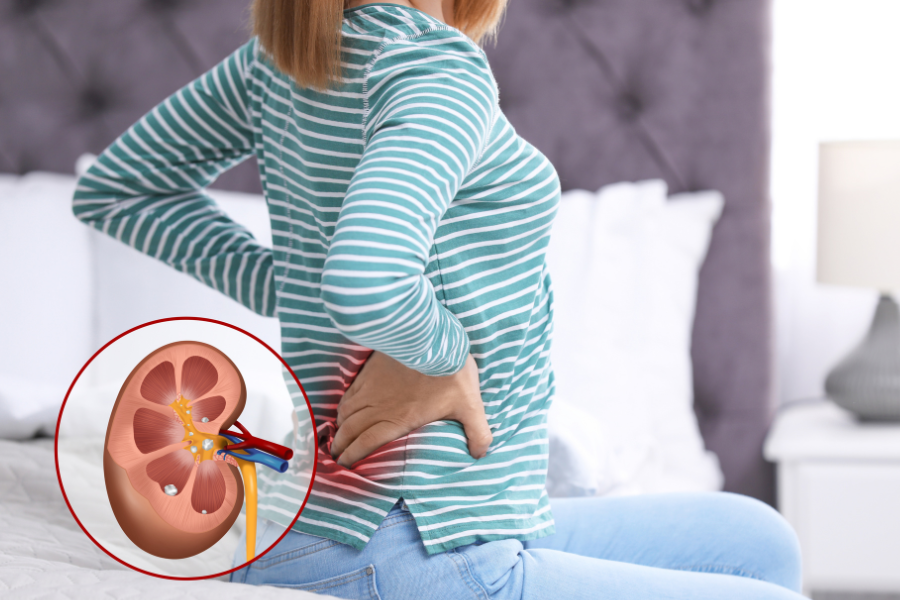 AWAS! Anda Boleh Dapat Batu Karang Jika Selalu Ambil 3 Jenis Makanan Ini