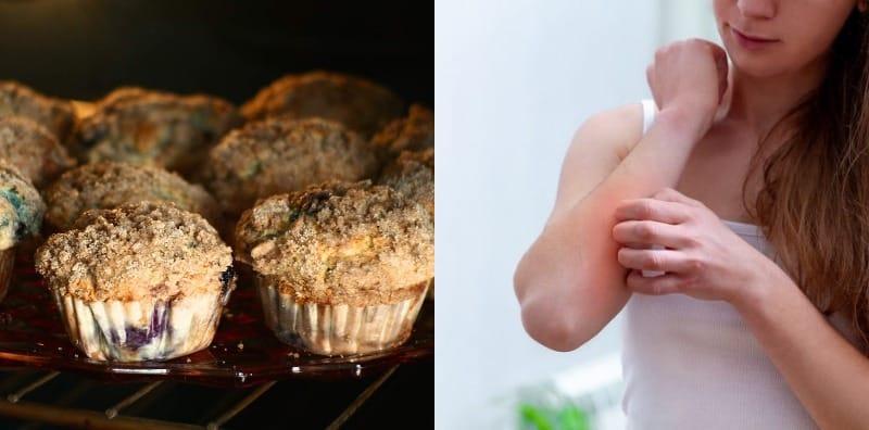 AWAS, Ada Bahan Dalam Masakan Boleh Jadi Punca Alahan! Ini Cara Mengatasinya