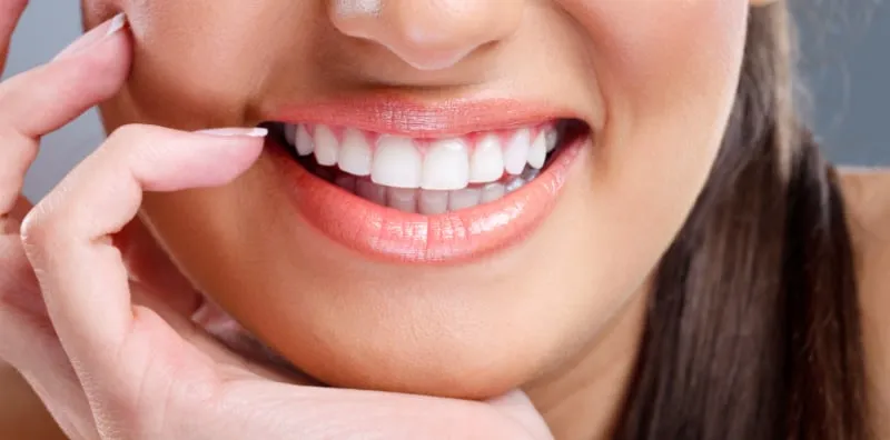 Perlu Ke Buat Rawatan Pemutihan Gigi? Sebelum Itu, Ambil Tahu Risikonya Dahulu