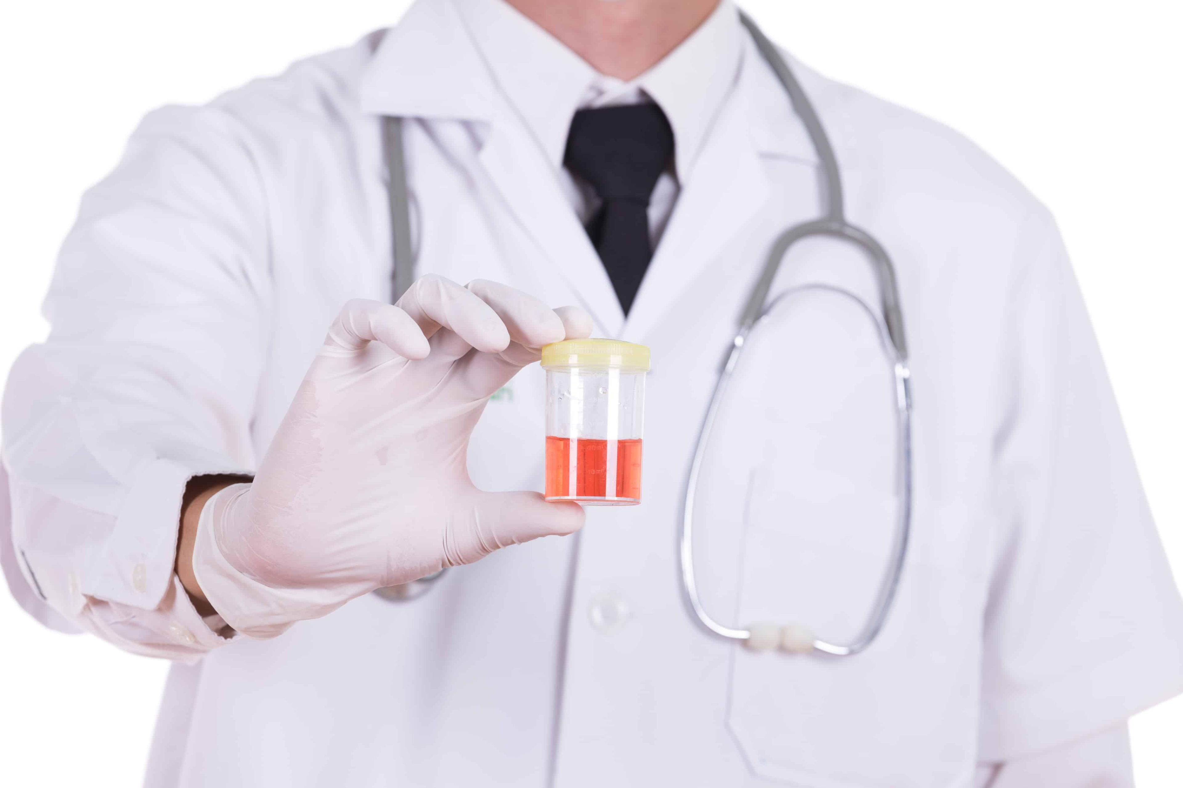 Blood In The Urine: What Could Cause It?