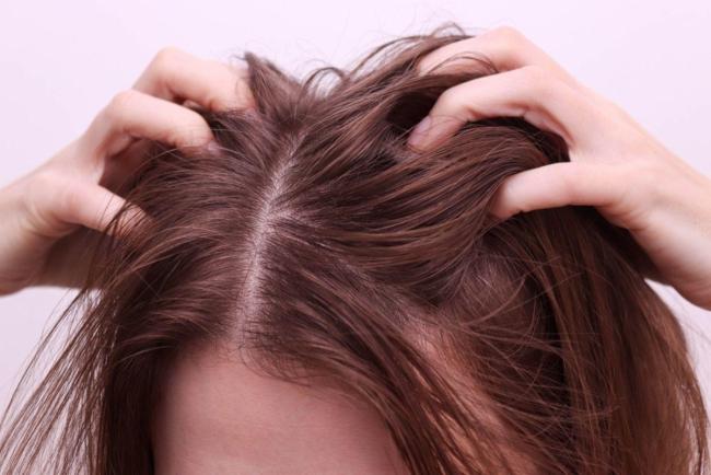 Kutu Pada Rambut: Bagaimana ia Berlaku?