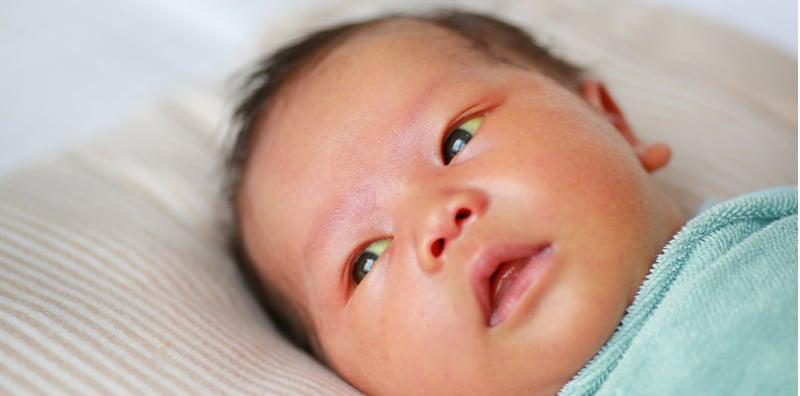 Betul Ke Susu Ibu Punca Baby Kuning? Ayuh Ketahui Sebab Jaundis Pada Si Kecil